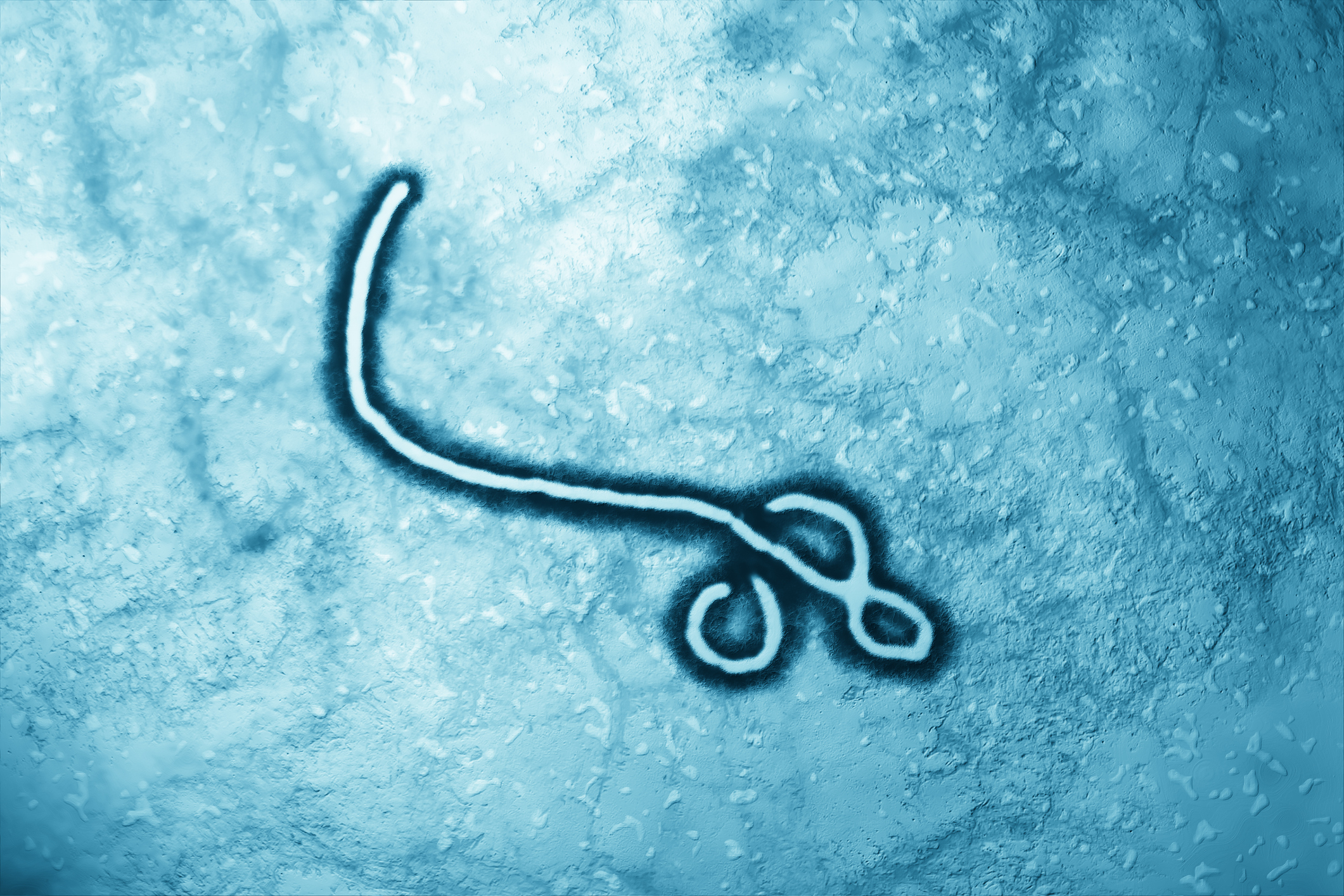 image of the Ebola virus under a microscope